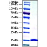 SDS-PAGE - Recombinant Human Galectin 7 Protein (A330683) - Antibodies.com