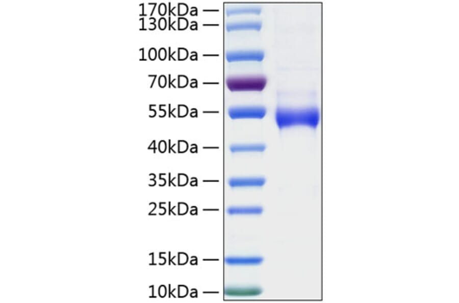 SDS-PAGE - Recombinant Human Galectin 9 Protein (N-terminal His Tag) (A330684) - Antibodies.com