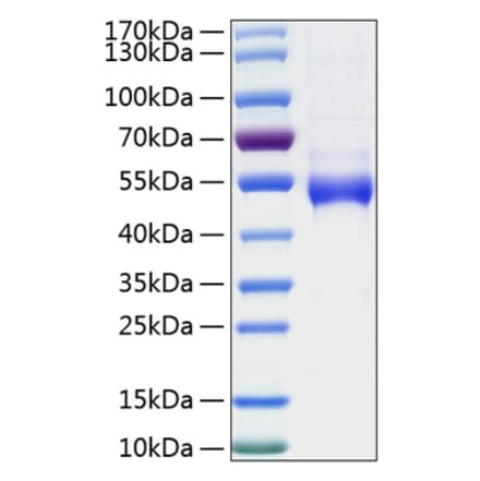 SDS-PAGE - Recombinant Human Galectin 9 Protein (N-terminal His Tag) (A330684) - Antibodies.com