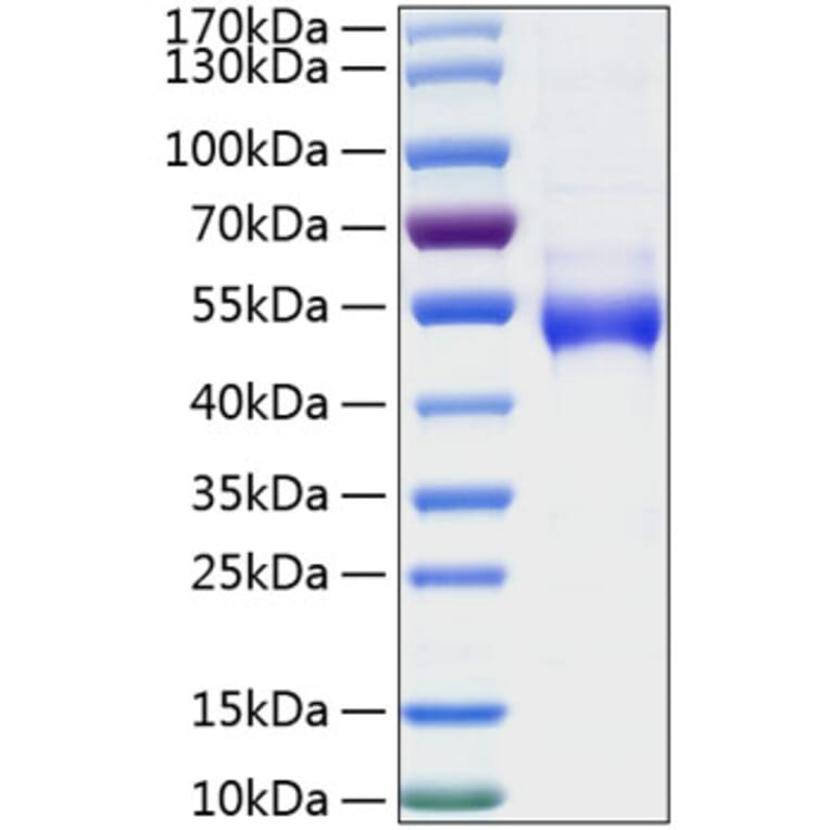 SDS-PAGE - Recombinant Human Galectin 9 Protein (N-terminal His Tag) (A330684) - Antibodies.com