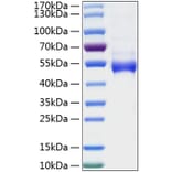 SDS-PAGE - Recombinant Human Galectin 9 Protein (N-terminal His Tag) (A330684) - Antibodies.com