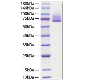 SDS-PAGE - Recombinant human GAS6 Protein (C-terminal His Tag) (A330685) - Antibodies.com