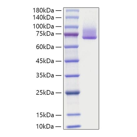 SDS-PAGE - Recombinant human GAS6 Protein (C-terminal His Tag) (A330685) - Antibodies.com