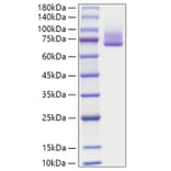 SDS-PAGE - Recombinant human GAS6 Protein (C-terminal His Tag) (A330685) - Antibodies.com