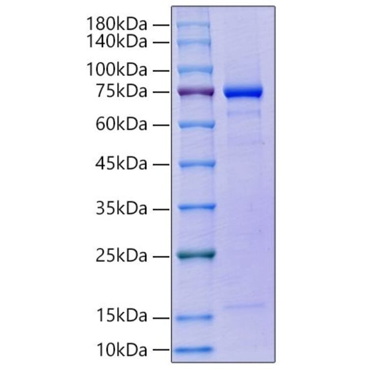 SDS-PAGE - Recombinant human GAS6 Protein (C-terminal His Tag) (A330685) - Antibodies.com