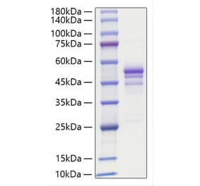 SDS-PAGE - Recombinant Human Gastrin Releasing Peptide Protein (C-terminal Human Fc Tag) (A330686) - Antibodies.com