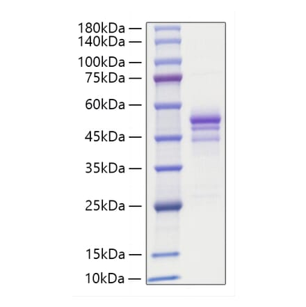 SDS-PAGE - Recombinant Human Gastrin Releasing Peptide Protein (C-terminal Human Fc Tag) (A330686) - Antibodies.com