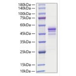 SDS-PAGE - Recombinant Human Gastrin Releasing Peptide Protein (C-terminal Human Fc Tag) (A330686) - Antibodies.com