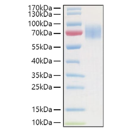 SDS-PAGE - Recombinant Human GC-C Protein (C-terminal His and Avi Tag) (A330687) - Antibodies.com
