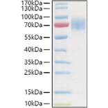 SDS-PAGE - Recombinant Human GC-C Protein (C-terminal His and Avi Tag) (A330687) - Antibodies.com