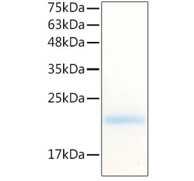 SDS-PAGE - Recombinant Human G-CSF Protein (C-terminal His Tag) (A330688) - Antibodies.com