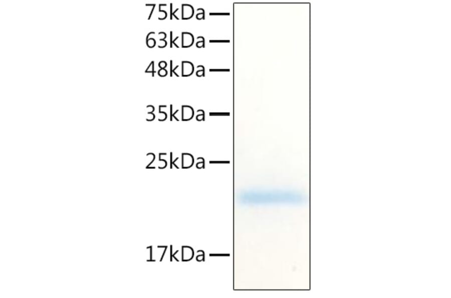 SDS-PAGE - Recombinant Human G-CSF Protein (C-terminal His Tag) (A330688) - Antibodies.com