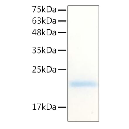 SDS-PAGE - Recombinant Human G-CSF Protein (C-terminal His Tag) (A330688) - Antibodies.com