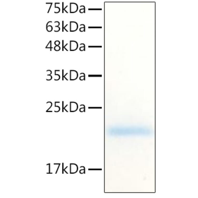 SDS-PAGE - Recombinant Human G-CSF Protein (C-terminal His Tag) (A330688) - Antibodies.com