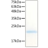 SDS-PAGE - Recombinant Human G-CSF Protein (C-terminal His Tag) (A330688) - Antibodies.com