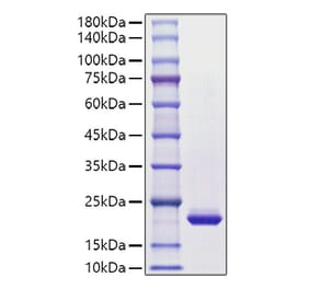 SDS-PAGE - Recombinant Human G-CSF Protein (C-terminal His Tag) (A330689) - Antibodies.com