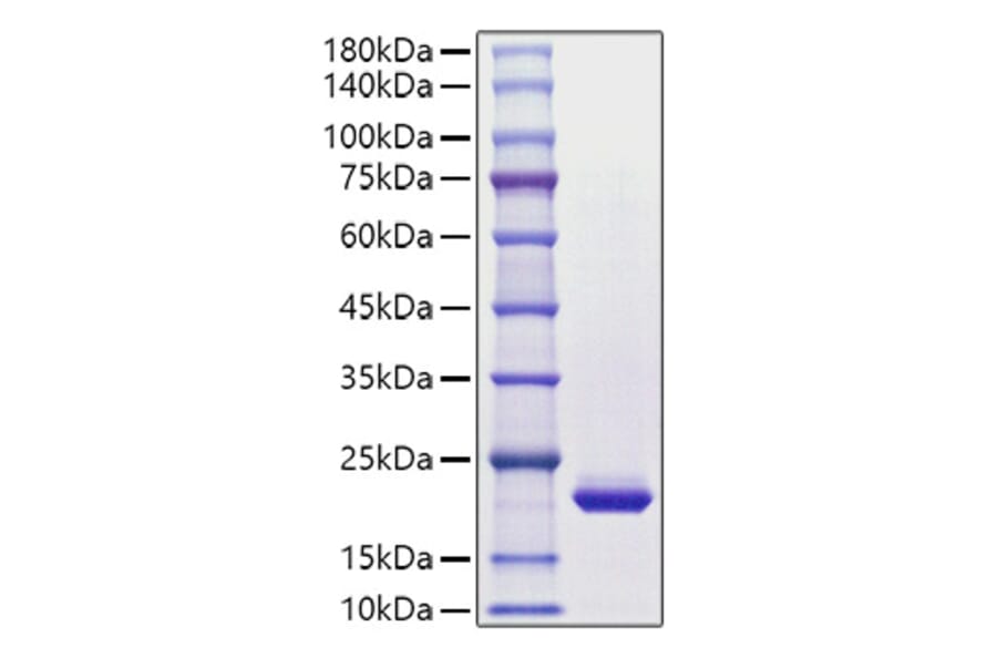 SDS-PAGE - Recombinant Human G-CSF Protein (C-terminal His Tag) (A330689) - Antibodies.com