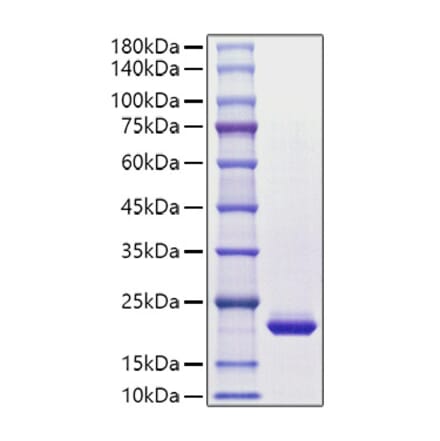 SDS-PAGE - Recombinant Human G-CSF Protein (C-terminal His Tag) (A330689) - Antibodies.com