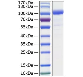 SDS-PAGE - Recombinant Human GCSF Receptor Protein (C-terminal His Tag) (A330690) - Antibodies.com