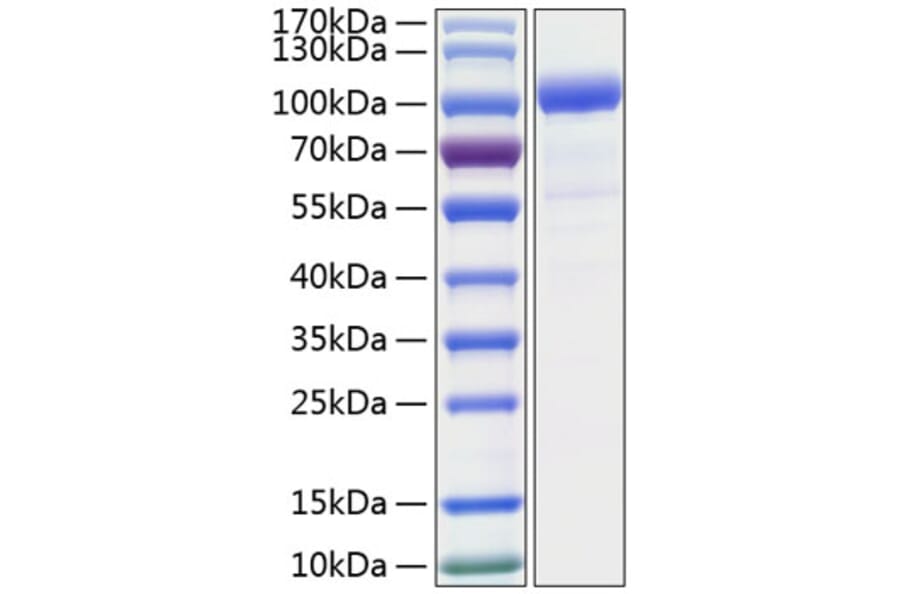 SDS-PAGE - Recombinant Human GCSF Receptor Protein (C-terminal His Tag) (A330690) - Antibodies.com