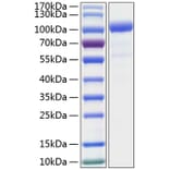 SDS-PAGE - Recombinant Human GCSF Receptor Protein (C-terminal His Tag) (A330690) - Antibodies.com