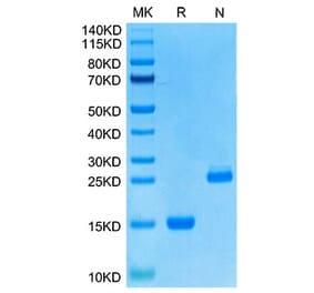 Tris-Bis PAGE - Recombinant Human GDF15 Protein (N-terminal His Tag) (A330692) - Antibodies.com