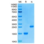 Tris-Bis PAGE - Recombinant Human GDF15 Protein (N-terminal His Tag) (A330692) - Antibodies.com