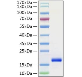 SDS-PAGE - Recombinant Human GDNF Protein (C-terminal His Tag) (A330694) - Antibodies.com