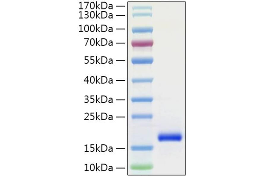 SDS-PAGE - Recombinant Human GDNF Protein (C-terminal His Tag) (A330694) - Antibodies.com