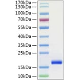 SDS-PAGE - Recombinant Human GDNF Protein (C-terminal His Tag) (A330694) - Antibodies.com
