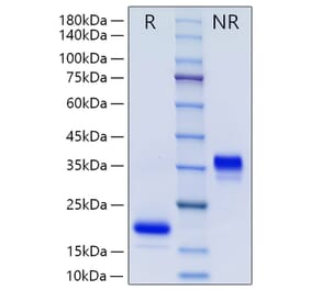 SDS-PAGE - Recombinant Human GDNF Protein (N-terminal His Tag) (A330695) - Antibodies.com