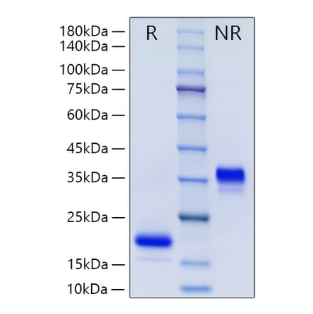 SDS-PAGE - Recombinant Human GDNF Protein (N-terminal His Tag) (A330695) - Antibodies.com