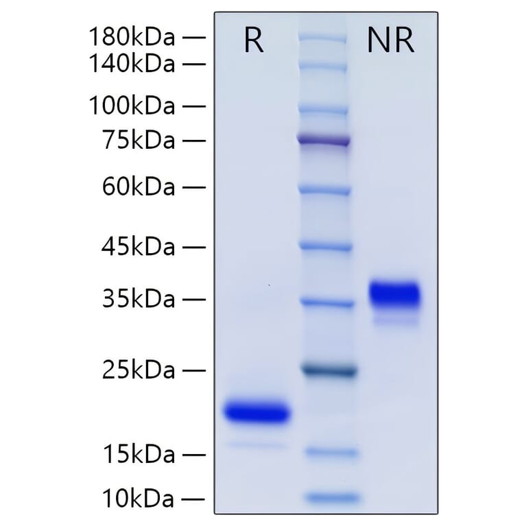 SDS-PAGE - Recombinant Human GDNF Protein (N-terminal His Tag) (A330695) - Antibodies.com