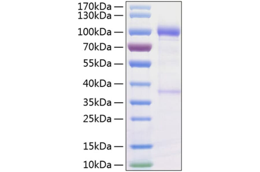 SDS-PAGE - Recombinant Human GDNF Receptor alpha 1/GFRA1 Protein (C-terminal Human Fc and His Tag) (A330696) - Antibodies.com