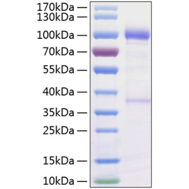 SDS-PAGE - Recombinant Human GDNF Receptor alpha 1/GFRA1 Protein (C-terminal Human Fc and His Tag) (A330696) - Antibodies.com