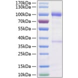 SDS-PAGE - Recombinant Human GDNF Receptor alpha 1/GFRA1 Protein (C-terminal Human Fc and His Tag) (A330696) - Antibodies.com