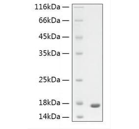 SDS-PAGE - Recombinant Human GFAP Protein (N-terminal His Tag) (A330697) - Antibodies.com