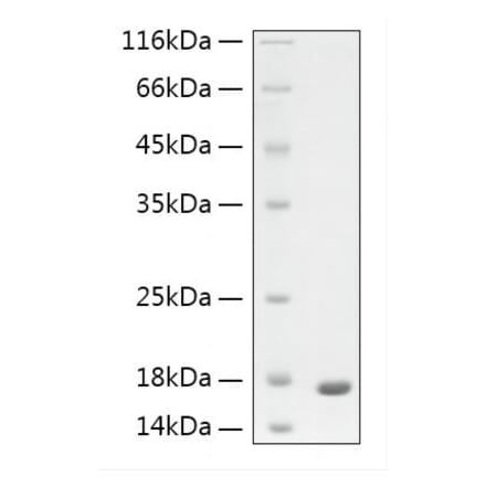 SDS-PAGE - Recombinant Human GFAP Protein (N-terminal His Tag) (A330697) - Antibodies.com