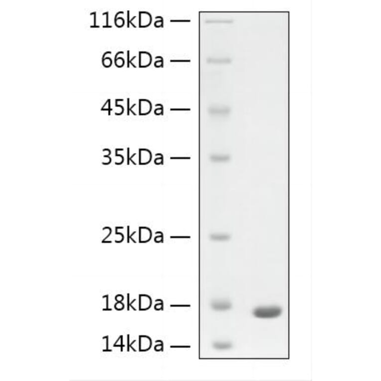 SDS-PAGE - Recombinant Human GFAP Protein (N-terminal His Tag) (A330697) - Antibodies.com