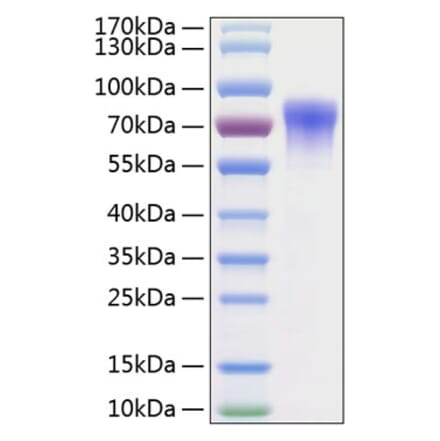 SDS-PAGE - Recombinant Human GFRA2 Protein (C-terminal His Tag) (A330698) - Antibodies.com