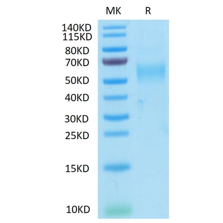 Tris-Bis PAGE - Recombinant Cynomolgus macaque GFRAL Protein (N-terminal His and Avi Tag) (A330699) - Antibodies.com