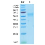 Tris-Bis PAGE - Recombinant Cynomolgus macaque GFRAL Protein (N-terminal His and Avi Tag) (A330699) - Antibodies.com