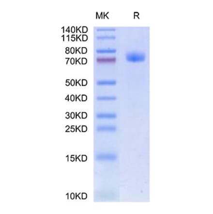 Tris-Bis PAGE - Recombinant Human GFRAL Protein (C-terminal Human Fc Tag) (A330700) - Antibodies.com
