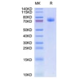 Tris-Bis PAGE - Recombinant Human GFRAL Protein (C-terminal Human Fc Tag) (A330700) - Antibodies.com