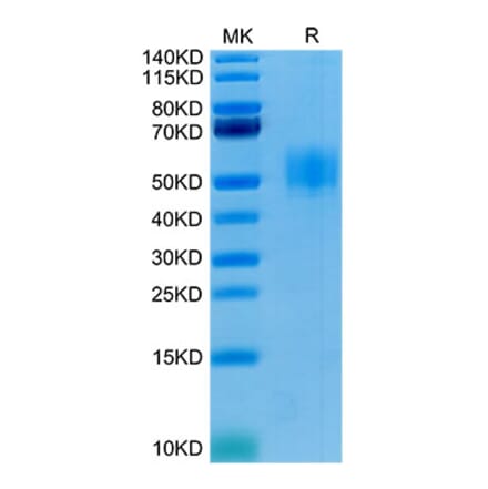 Tris-Bis PAGE - Recombinant Human GFRAL Protein (C-terminal His and Avi Tag) (A330701) - Antibodies.com