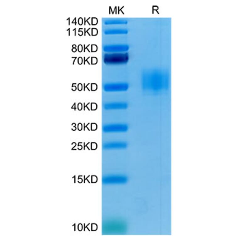 Tris-Bis PAGE - Recombinant Human GFRAL Protein (C-terminal His and Avi Tag) (A330701) - Antibodies.com