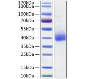 SDS-PAGE - Recombinant Human GGH Protein (C-terminal His Tag) (A330702) - Antibodies.com