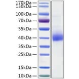 SDS-PAGE - Recombinant Human GGH Protein (C-terminal His Tag) (A330702) - Antibodies.com