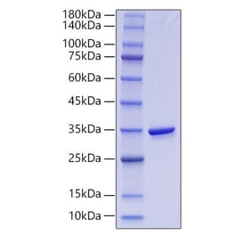 SDS-PAGE - Recombinant Human GGH Protein (N-terminal His Tag) (A330703) - Antibodies.com