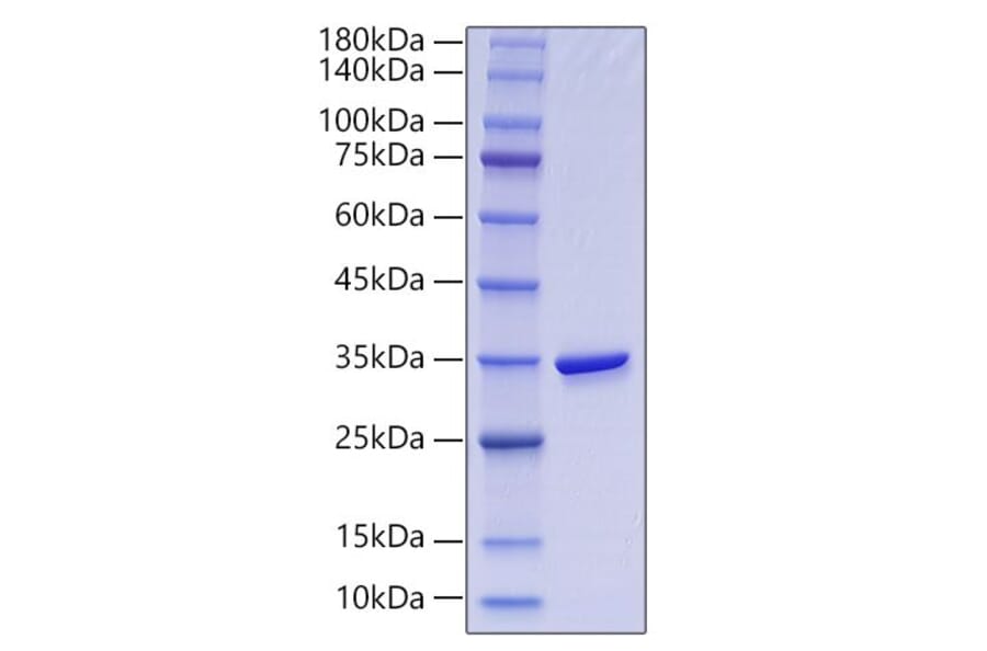SDS-PAGE - Recombinant Human GGH Protein (N-terminal His Tag) (A330703) - Antibodies.com